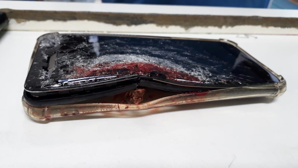 Criminoso assalta motorista em Gravataí, atira e bala fica alojada no celular da vitima