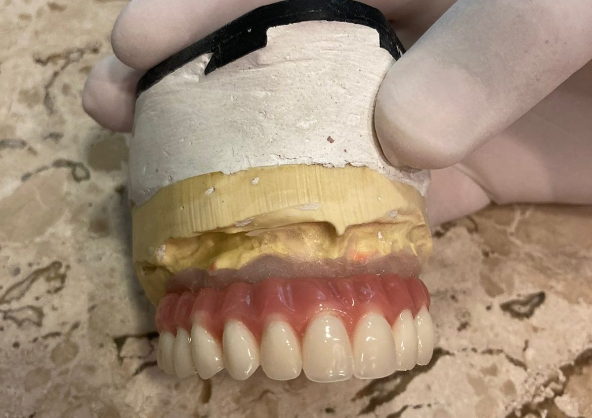 Oral Sin | Tecnologia do protocolo dentário traz segurança e torna dentaduras obsoletas